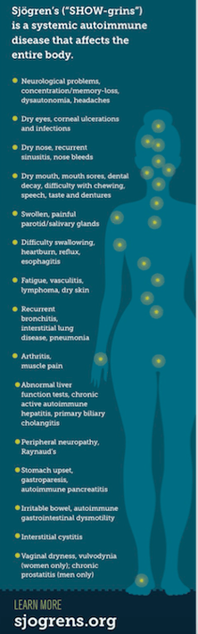 Sjogren's Body 2017.png